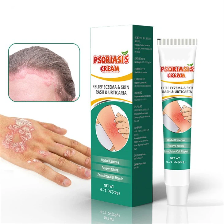 Dermatitis Pruritus Psoriasis Cream Ointment