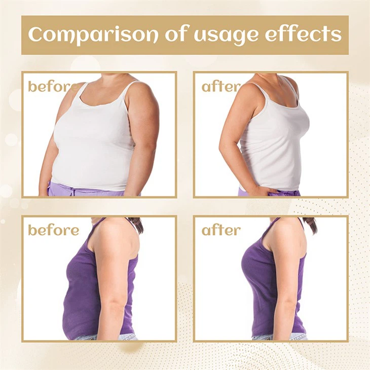 Navel Herbal Slimming Patches For Weight Loss